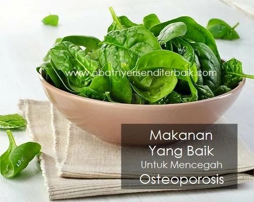 Makanan Yang Baik Untuk Mencegah Osteoporosis